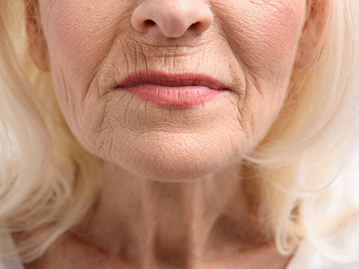 microneedling for smokers lines