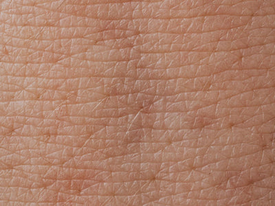 microneedling for hyperpigmentation