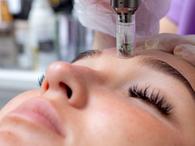 is microneedling safe