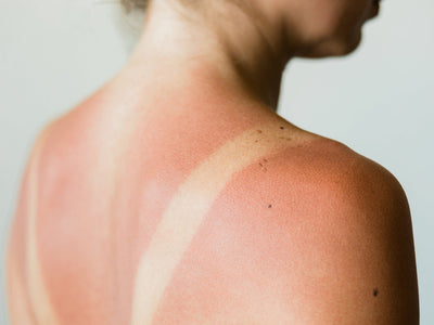 microneedling dark spots