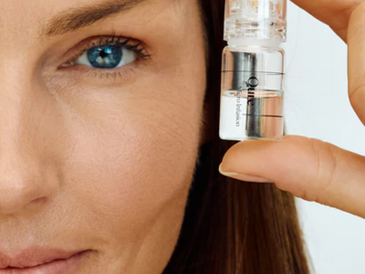 microneedling for blackheads