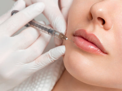 how long after microneedling can you get filler