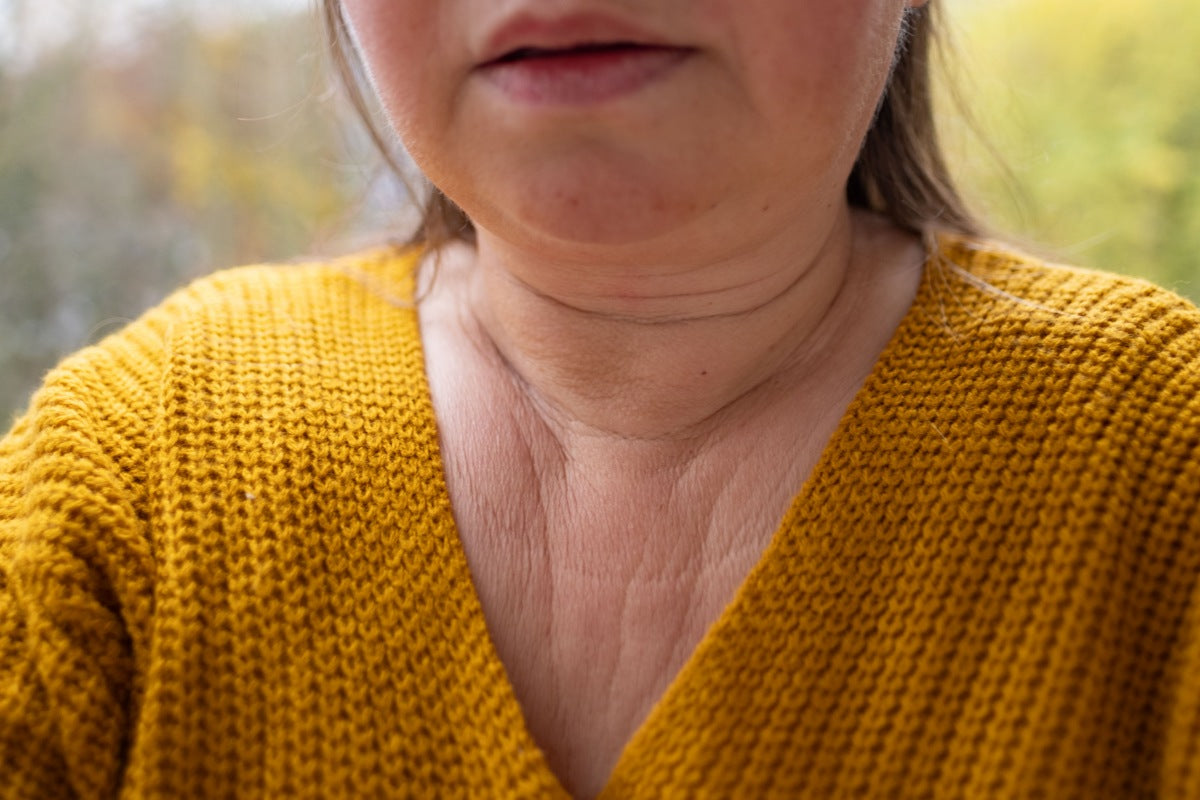 red light therapy for neck wrinkles 1