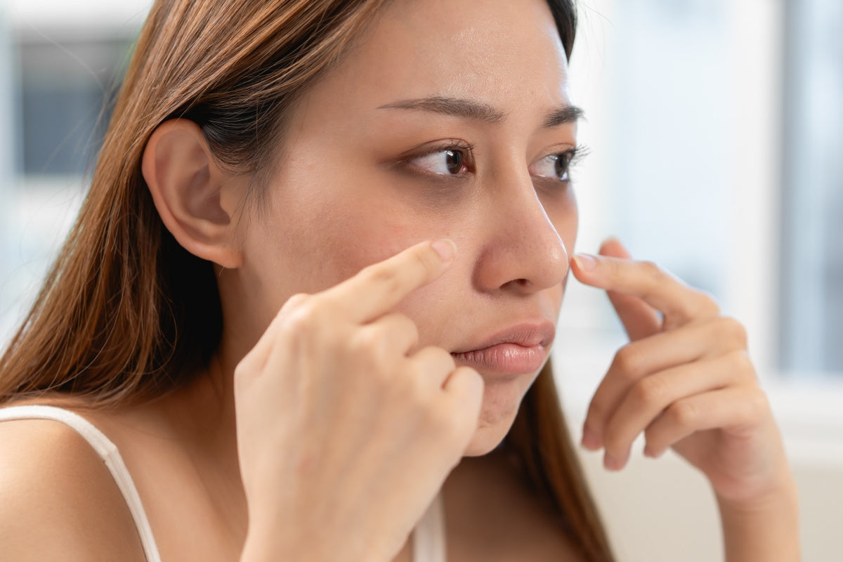 red light therapy dark circles