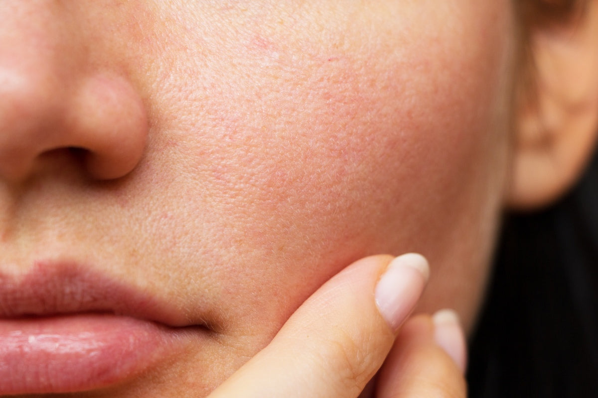 Liquid error (sections/article line 41): invalid url input