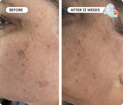 Fade & Firm Bundle Pro