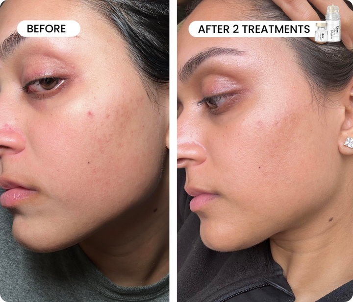Fade & Firm Bundle Pro