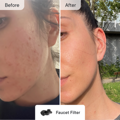 Breakout Control Pro