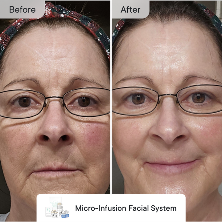 Line Refine Bundle Essential