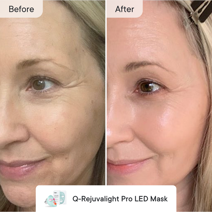 Line Refine Bundle Pro