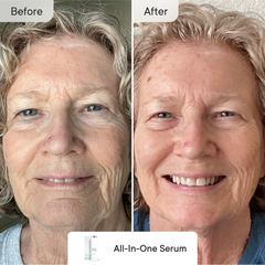 Line Refine Bundle Pro