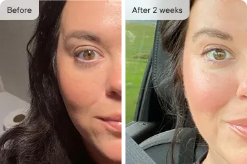 Woman's face split in half; before and after, with text labels.