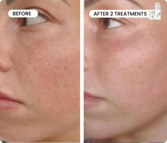 Fade & Firm Bundle Advanced