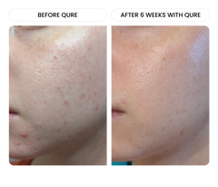 All-In-One Face Serum 6 Month Bundle